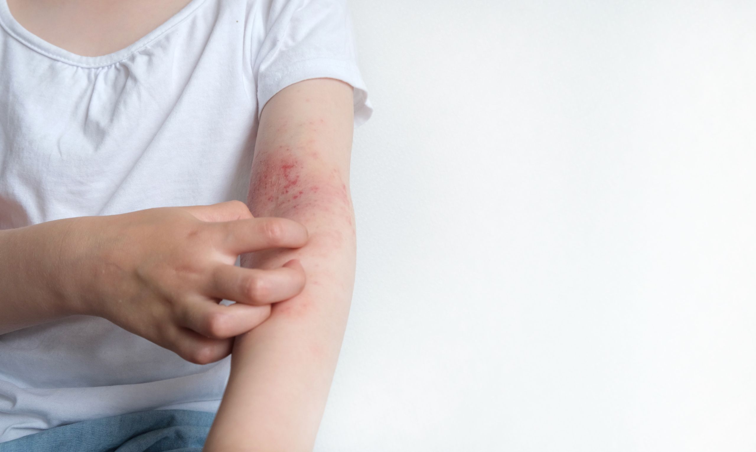 Same-Day Dermatology Appointments Chevy Chase