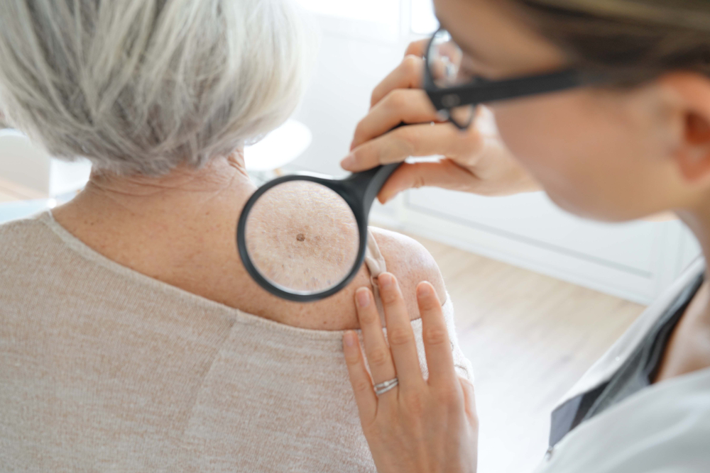 Best Skin Cancer Doctor in Chevy Chase