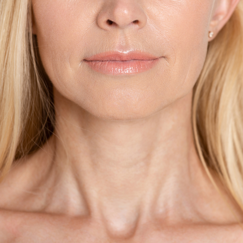 nonsurgical turkey neck treatment