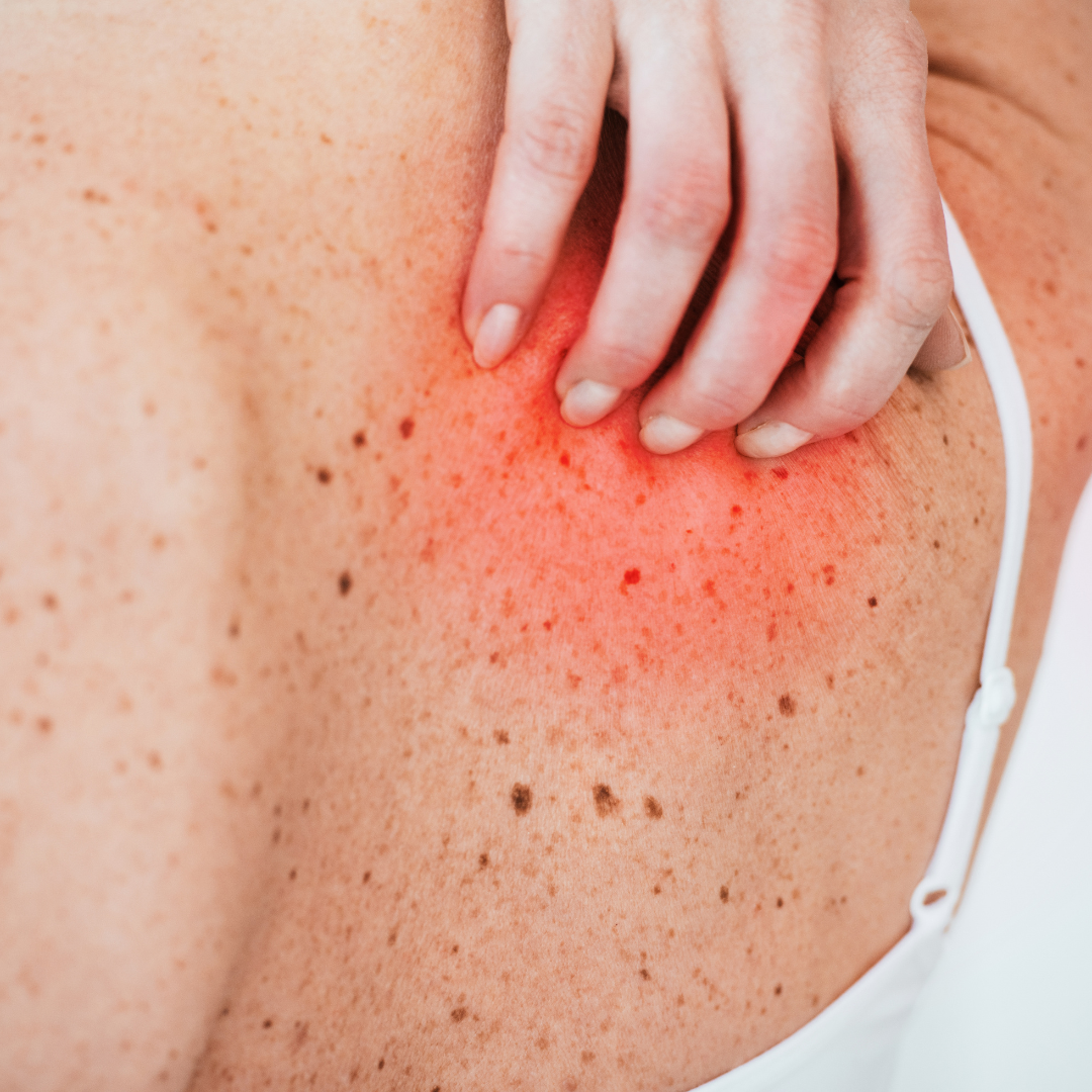 Urgent Care for Dermatology in Chevy Chase